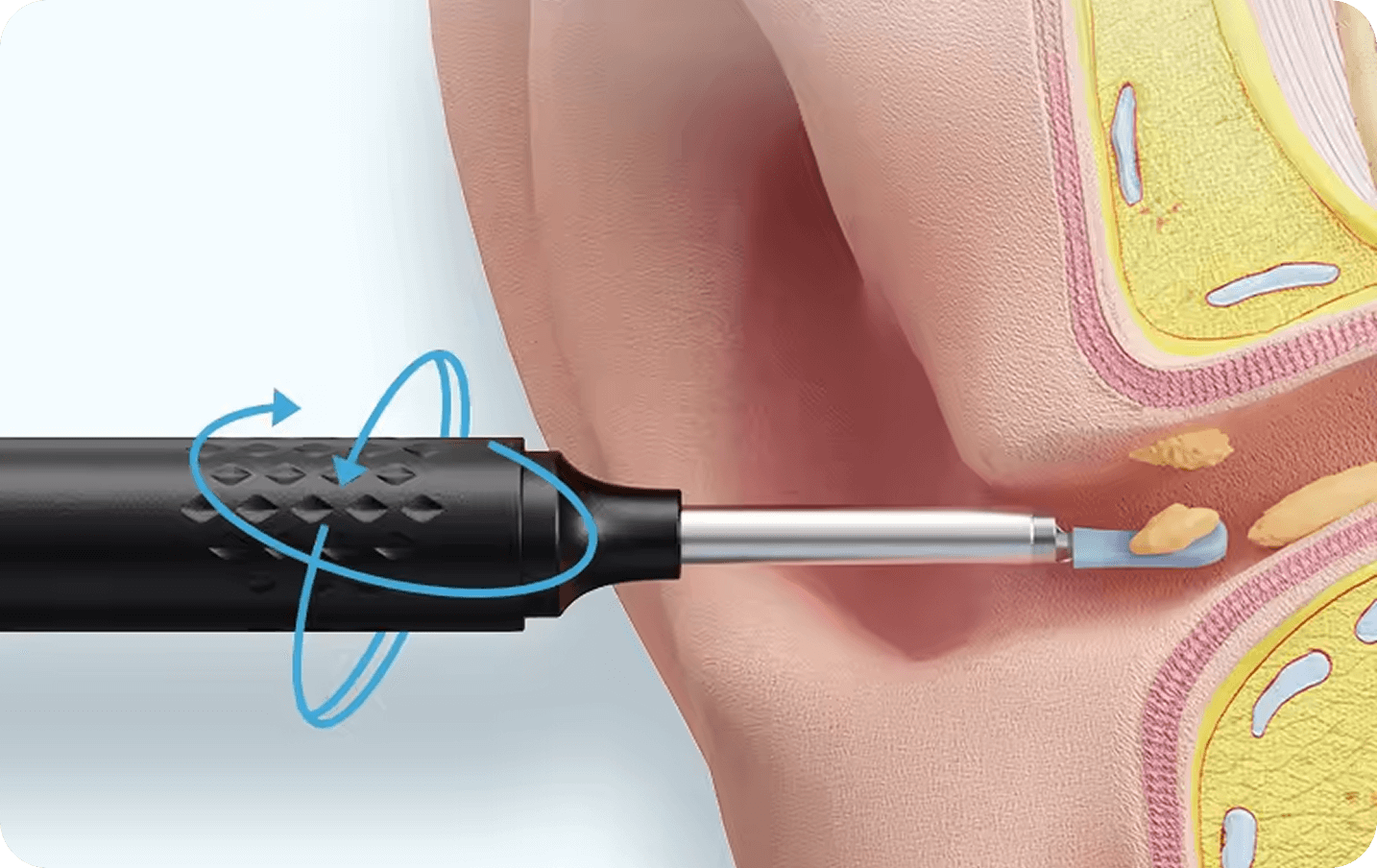 Vital Ear Cleaner (Official Retailer) 2026